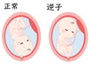 「【逆子が気になる方へ。赤ちゃんが“動きやすいお腹”をつくるケア】」