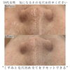 「50代女性のお客様の変化と声【福井毛穴サロン/福井シワ改善/復元フェイシャル】」