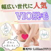 「幅広い世代に人気！VIO脱毛」
