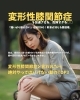 コラム「変形性膝関節症を加速させる、危険すぎる○○ 「痛いから動かない」は絶対NG!軟骨が消える悪循環。 」