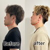 お客様ビフォーアフター🌈「【男性Before/after】エラはり解消!フェイスライン激変!『顔変わったね!』と気づかれるOTEIREの秘密✨ 【札幌北区篠路プライベートサロン　Te-tora】脳波と骨格を整え睡眠の質を上げる安眠サロン」