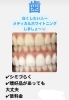 「歯を白くしたい方へ！aileのメディカルホワイトニング」