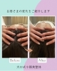 「【ビフォーアフター】大口式小顔美整体で歪みを整え、スッキリ小顔へ！」