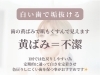メディカルホワイトニング「【白い歯は垢抜けへの近道】黄ばみは不潔な印象に！？」