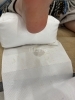 足裏角質ケア　ケア後は沢山、角質が出ています「足裏角質ケアも大人気【福山駅前】爪Labo爪のお悩み専門サロン」