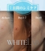シミ取り「【症例写真】長年のお悩みだったシミがたった7日間で！？」