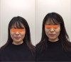 右は施術後、フェイスラインがすっきり「X'mas プレゼント【小顔+むくみ・たるみ解消】美容整体」