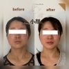 ぼやけたフェイスラインがクッキリ「2025年も残りわずか！今年1年のお顔の疲れ、溜め込んでいませんか？」