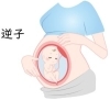 「骨盤と胎盤の環境を整えて、赤ちゃんが動きやすいお腹づくりを」