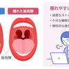 【お知らせ】院長の入院手術と診療再開のご案内／風邪・扁桃腺の基礎知識もあわせて