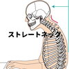 「【ストレートネック】不調の原因!?首だけ施術しても余り意味は無い」