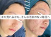 「また荒れるかも....そんな不安のない毎日へ」