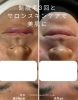 男性も綺麗な肌に！清潔感アップ！「男性も肌管理や脱毛をはじめてみませんか？」