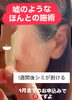 WhiteLAB「【1月お申込み限定】嘘のようなホントのシミケア体験しませんか？」