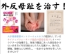 施術体験は公式LINEかお電話から「歩くだけで外反母趾が治る！？」