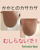 むしらずに、ケア！「【フットスキンケア】かかと、むしらないで！」