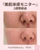 肌質改善”before/after”「静岡市葵区エステMIISA｜美肌体感モニター2週間の変化レポート」