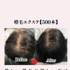 ✨【増毛エクステ500本】Before → After✨