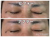 1回でこの違い！目の周りは効果がわかりやすいです「すぐわかる実感もながーく続く実感も両方味わえるダクトピール」