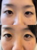 理想の目力をお約束、自分史上最高の目元を「ビフォーアフターで分かる♡まつげエクステで変わる目元印象のお話」