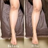お悩みのむくみにサヨナラ！Before/After「リフレクソロジー Before→After/むくみケアの変化」