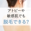 アトピー・敏感肌の方の脱毛についてよくあるご質問