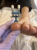 巻き爪ケアならお任せください「巻き爪の施術は痛い？初めての方から一番多い質問にお答えします【三島市フットケア】」