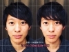 小顔矯正ビフォーアフター「【小顔矯正ビフォーアフター⑩】」