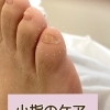 【ネイルケア】小爪⁈小指のケア