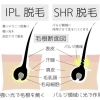 いまさら聞けないIPLとSHRの違い｜これから脱毛を始める方へ