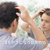 男性のAGA・薄毛のご相談も増えています｜境港・米子の発毛サロン セトラクション