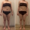 お腹まわりスッキリ！セルライトケアで1〜2ヶ月後の変化例のご紹介