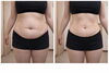無理なダイエットの落とし穴「痩せたのに…老けた？それ本当に理想のダイエット？」