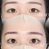 下がりまつ毛改善｜まつ毛パーマでぱっちり目元に