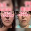 新生活のタイミングで美容鍼＆痩身ケアを始めてみませんか？
