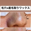 美濃市・関市の皆さまへ｜入学式は“毛穴レス×つるん肌”で写真映え✨『毛穴エクストラクション＋フェイシャルワックス』で一度で実感！
