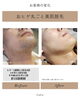Before→After 驚きの変化「おヒゲ脱毛ビフォーアフター　～早岐脱毛・リラクゼーション・毛穴洗浄・光フェイシャル～」
