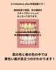 「歯の色で印象はこんなに変わる？セルフホワイトニングbefore after」