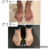 「外反母趾自体は痛くないのに、なぜ足が痛くなるのか？」 