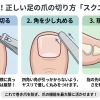 知られざる足の爪の役割と正しい切り方〈ドクターネイル爪革命苫小牧店〉