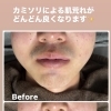 たった4回でこんなキレイに