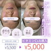 あなたの肌も驚く、プルプル美肌体験！「初回限定◎ビタミンC＋A導入でぷる艶肌ケアしませんか？」
