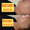 RED SHOTで美肌へ「薄着の季節前に レモンボトル×脂肪冷却で気になる部分を集中的にケアしませんか？」
