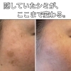 ファンデでもコンシーラーでも隠しきれない“頬のシミ”に。サロンで本気で使っている美白ケア化粧品、お見せします。【米子・松江・境港・伴走型エステ】