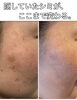 驚きの肌変化、シミもここまで薄く。「ファンデでもコンシーラーでも隠しきれない“頬のシミ”に。サロンで本気で使っている美白ケア化粧品、お見せします。【米子・松江・境港・伴走型エステ】」