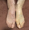 「米子の足もみ保健室🦶」