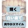 何年経っても白い歯へ！定着重視のメディカルホワイトニング