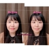 小顔矯正ビフォーアフター「【小顔矯正ビフォーアフター２４】」
