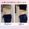 産後ママのための骨盤ケア✨