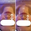 小顔フェイシャルで艶肌and小顔に！リフトアップ効果抜群！